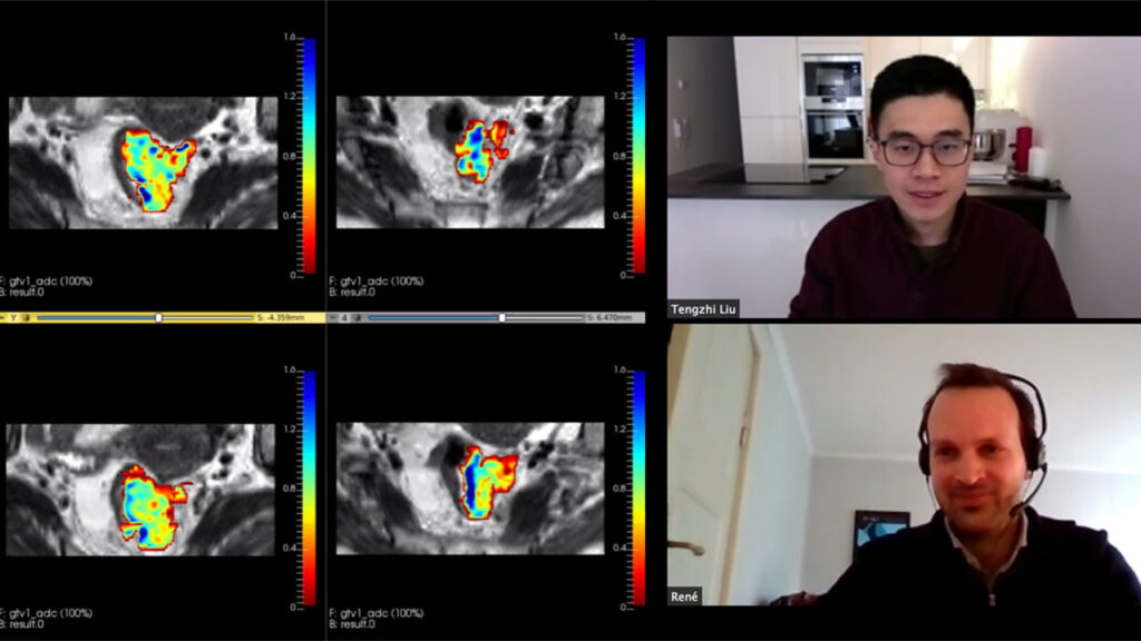 Et skjermbilde av et digitalt møte, som viser MR-bilder til venstre og to menn til høyre.