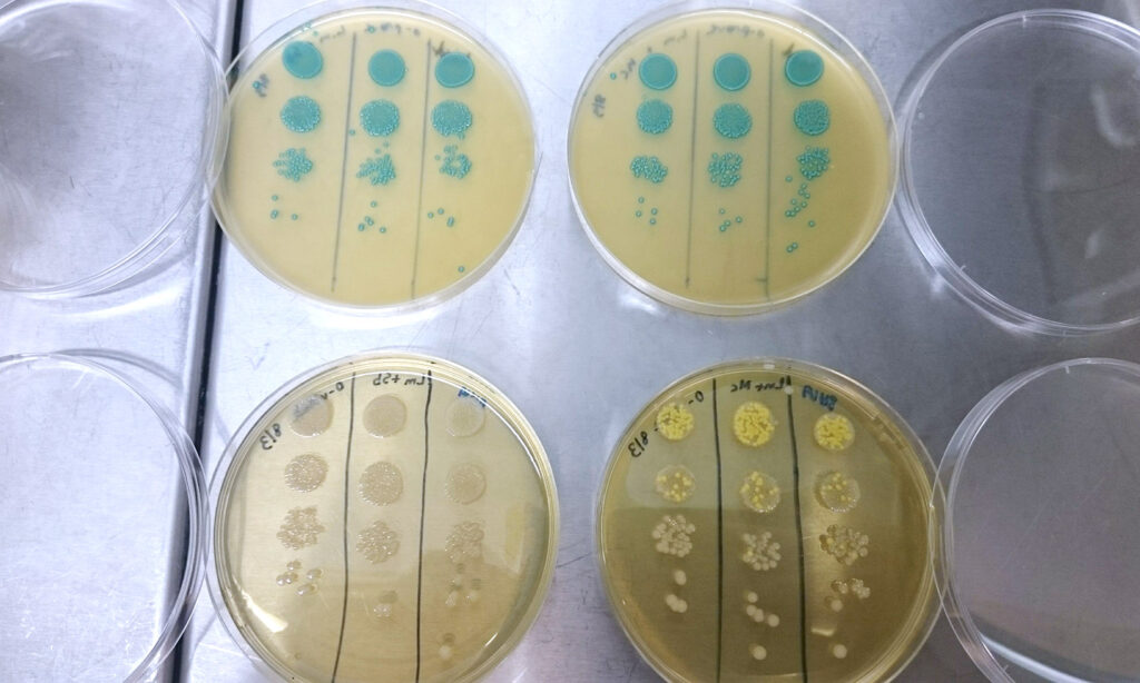 Bilde av bakterieprøver.