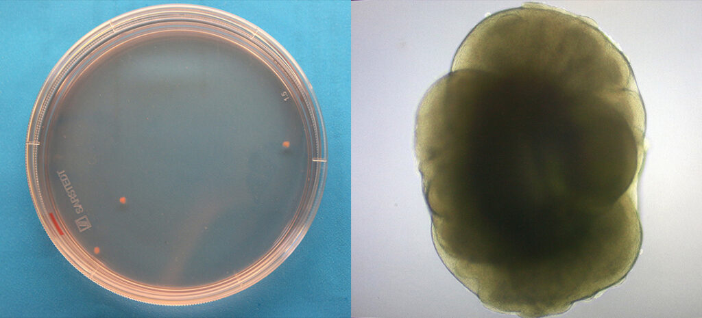 Minihjerner som ligger i en plast skål, og bildet til høyre er en minihjerne sett gjennom mikroskop.
